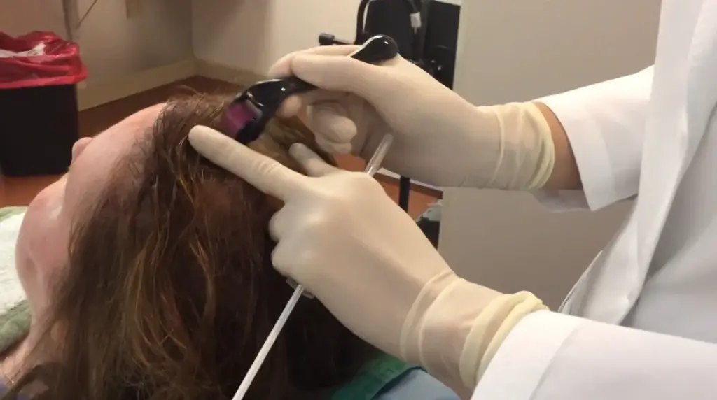 PRP tretman za poboljšanje rasta kose