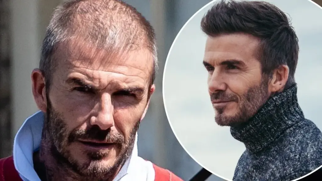 Šta se zapravo desilo sa Bekamovom kosom?