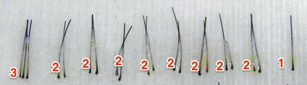 Cena transplantacije kose