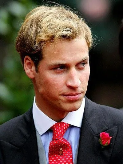 Opadanje kose kod mladog muškarca