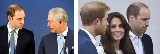 Opadanje kose kod mladog muškarca