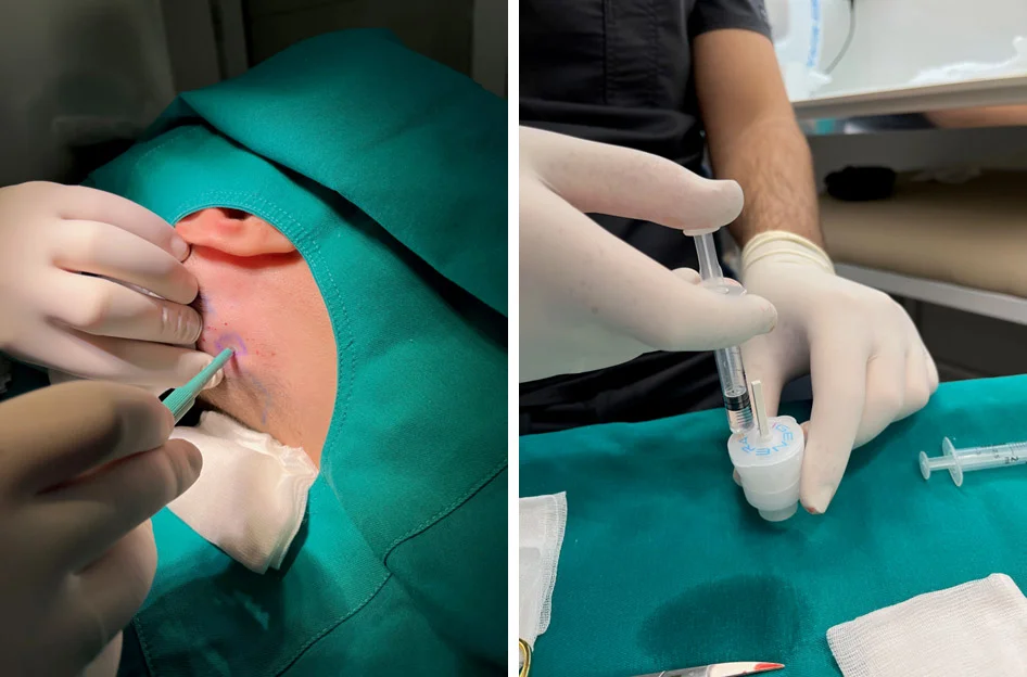 Folikularne matične ćelije