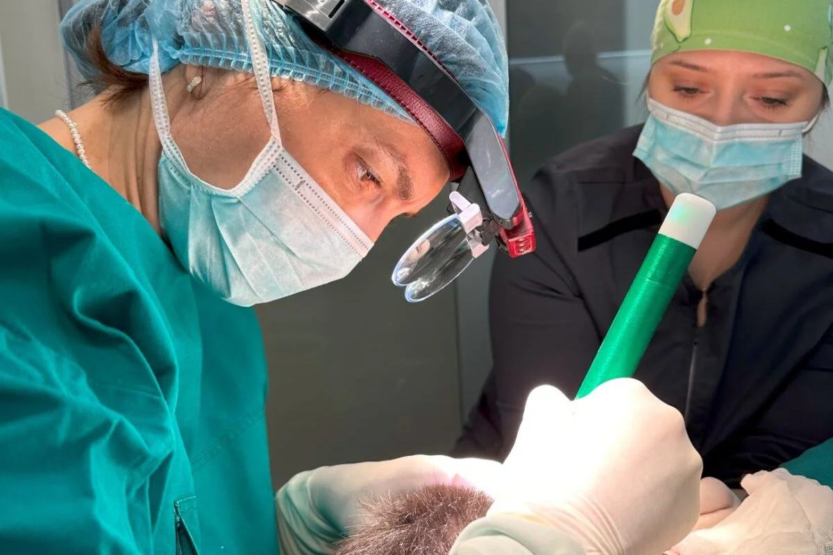 Transplantacija kose kao trend: Estetski, ali i zdravstveni izazov